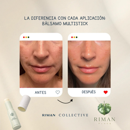 Multi Stick Balm ICD